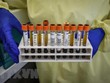 Italy thử nghiệm thành công kháng thể chống virus SARS-CoV-2