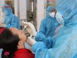 TP.HCM truy tìm trường hợp liên quan 2 ca tái dương tính SARS-CoV-2 ở Hà Tĩnh