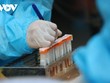 Bộ Y tế yêu cầu kiểm tra, giám sát giá dịch vụ xét nghiệm COVID-19