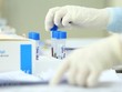 Bắc Kạn phát hiện một trường hợp tái dương tính với SARS-CoV-2
