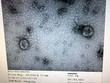 Việt Nam nuôi cấy và phân lập thành công virus corona mới