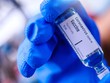 Reuters: Quan chức hàng đầu FDA sẽ từ chức nếu cấp phép một loại vắc xin chưa được chứng minh